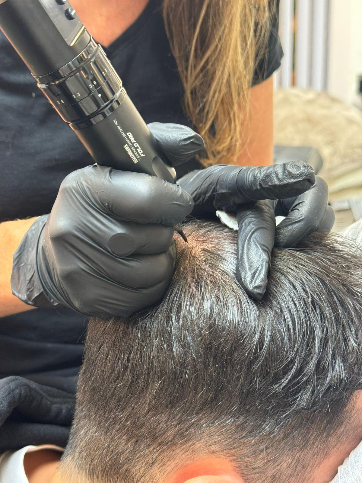 Specialiste brengt pigment aan op de hoofdhuid tijdens micro haar pigmentatie